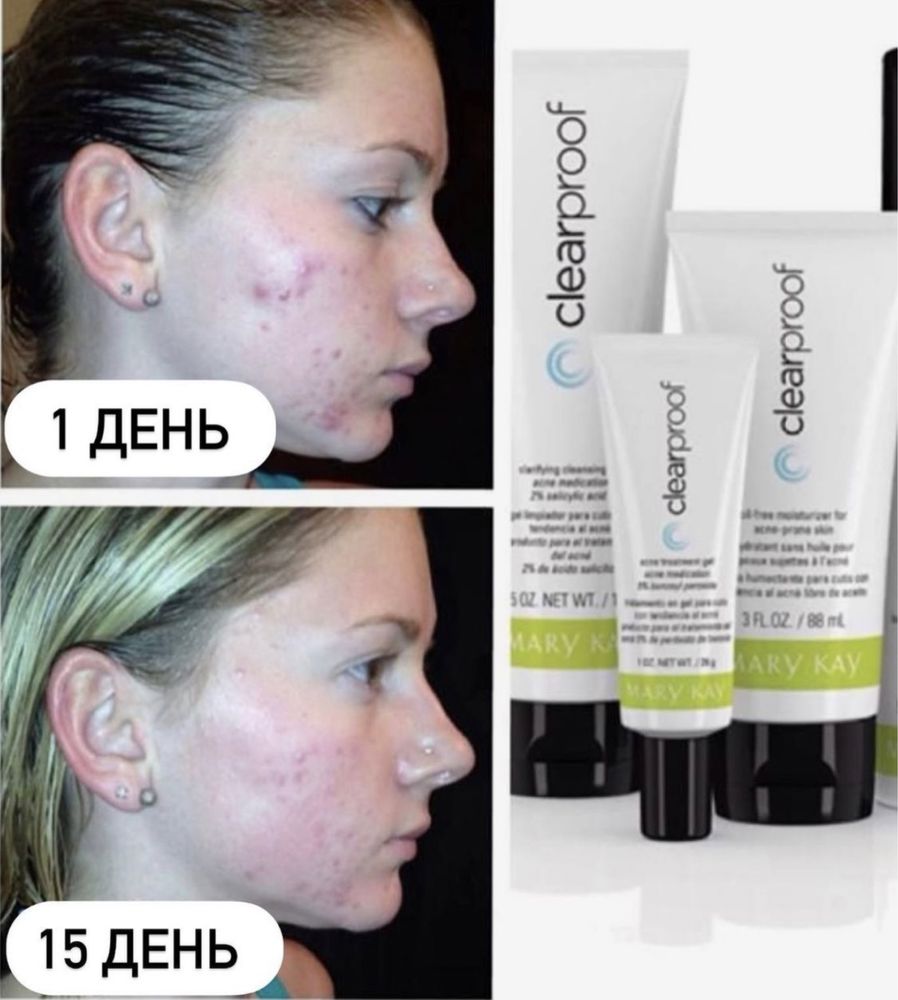 Купить Гель против прыщей Mary Kay Clear Proof — НОВИНКА, цена 2 руб — (), США