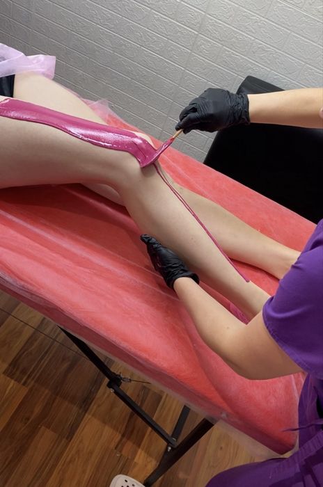 Эластомерная депиляция