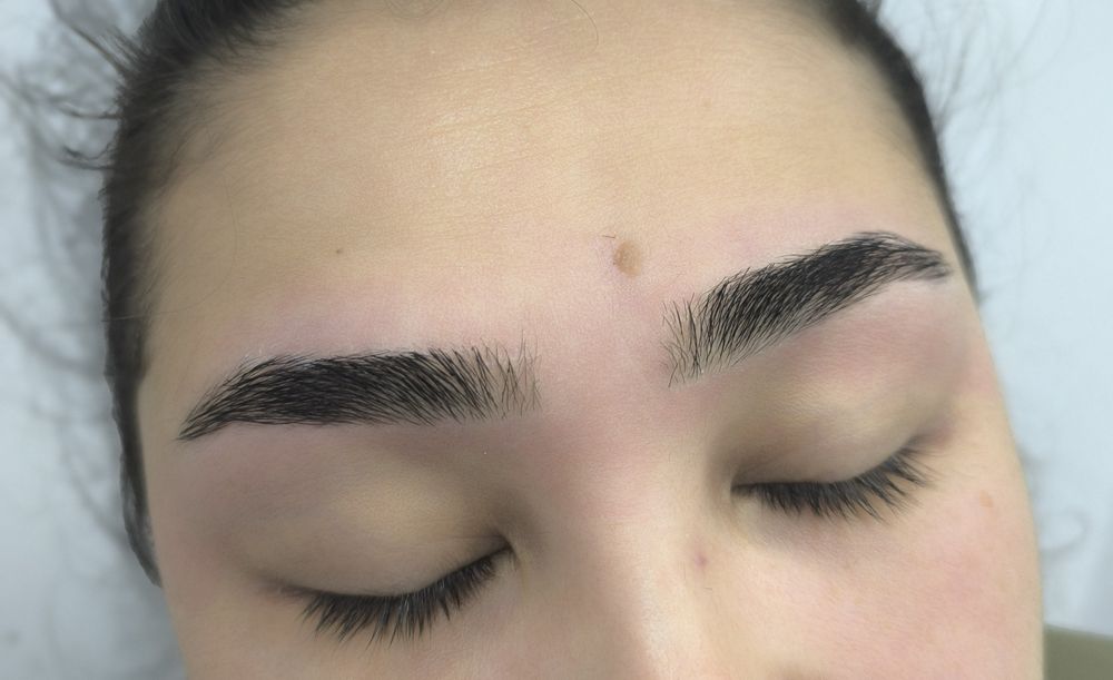 Красота это -губки бантиком на новый год! Botox full face