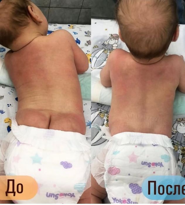 Детский оздоровительный массаж