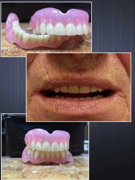 Зуботехническая Лаборатория Cad Cam ht st 4d pmma 3d shtml Протез