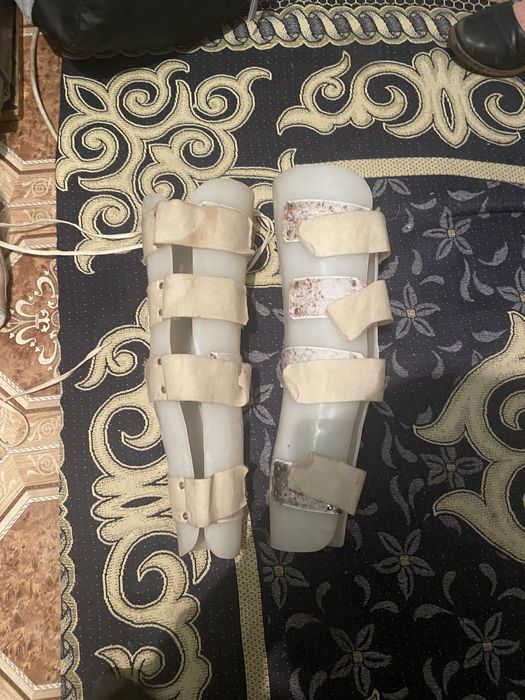 Аппарат ортопедический