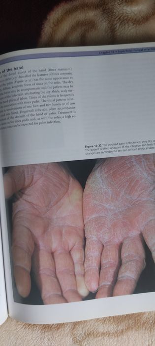 Carte Clinical Dermatology