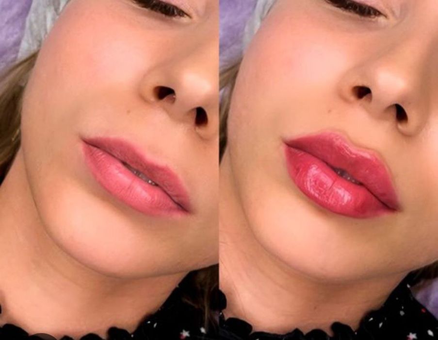 Cosmetologik pratseduralar barchasi mavjud erkak va ayollar uchun!