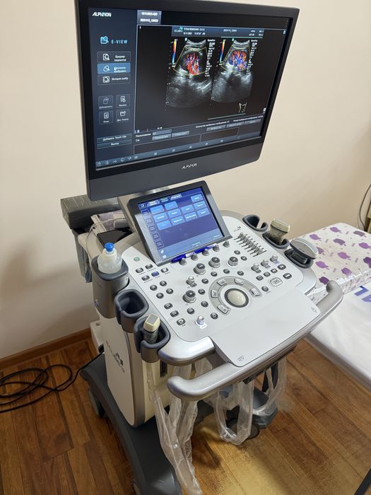 УЗИ аппарат холати аъло.