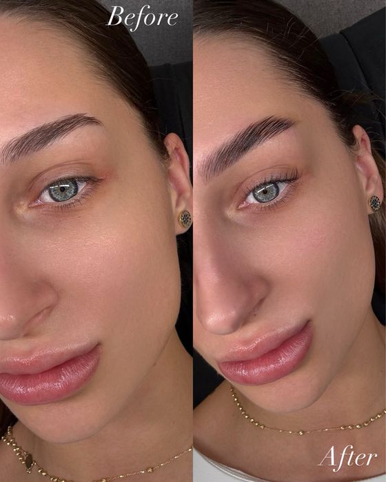 Servicii extensii gene - laminare