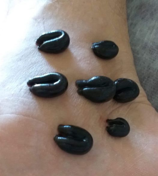 Лечебный массаж для вашего тела