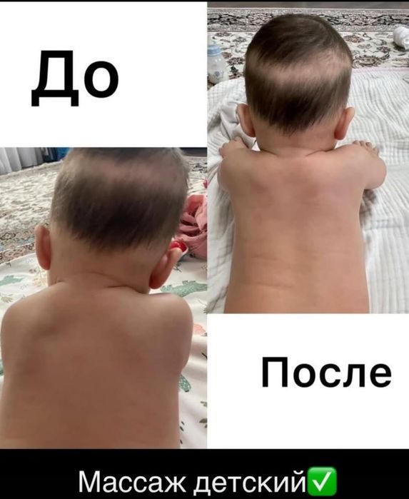 Детский оздоровительный массаж