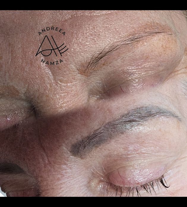Îndepărtare tatuaj sprâncene și corp | Laser | PMU/Microblading