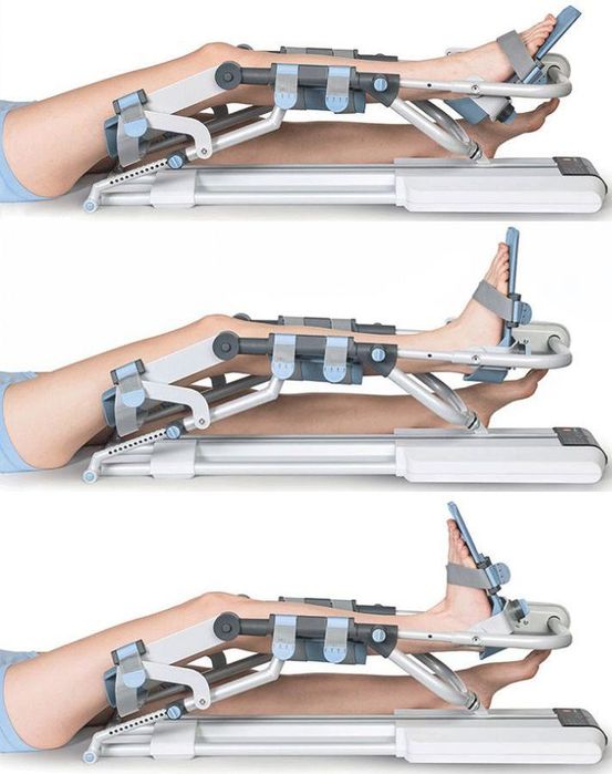 Inchiriez aparat recuperare genunchi,sold,glezna Kinetec/Artromot/CPM