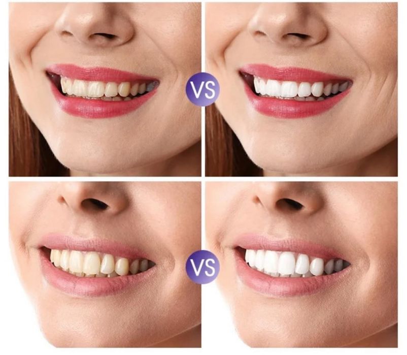 Spuma pentru albirea dintilor V 34