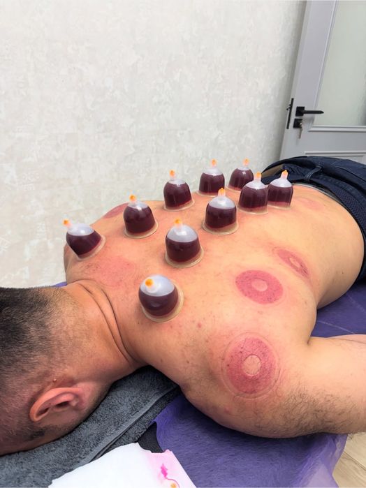 Xijoma Toshkentda uyga chaqruv xizmati