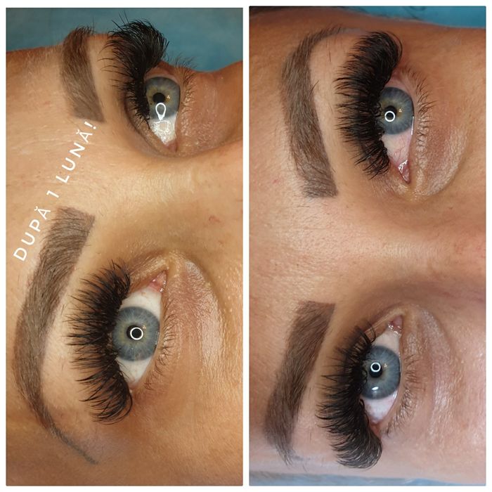 Extensii gene Timisoara