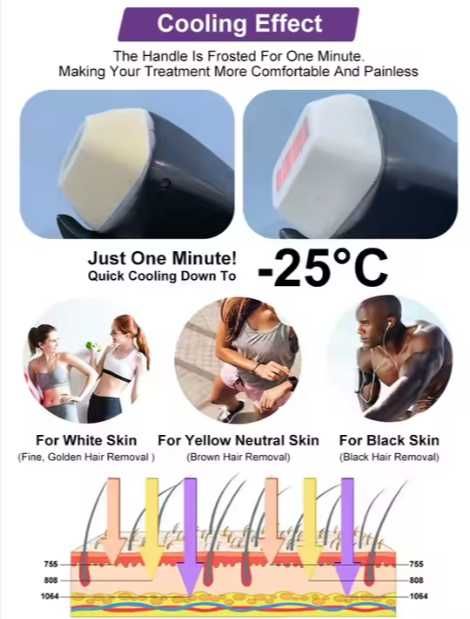 Косметологический аппарат Alma Soprano Titanium