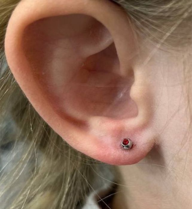 Прокол ушей детям и взрослвм