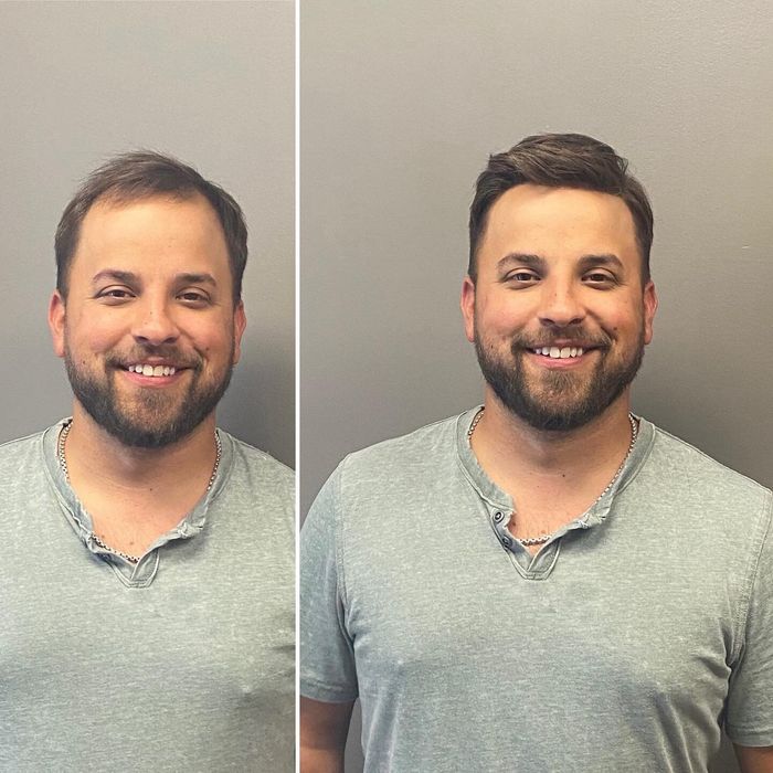 Мужские парики. Система волос.