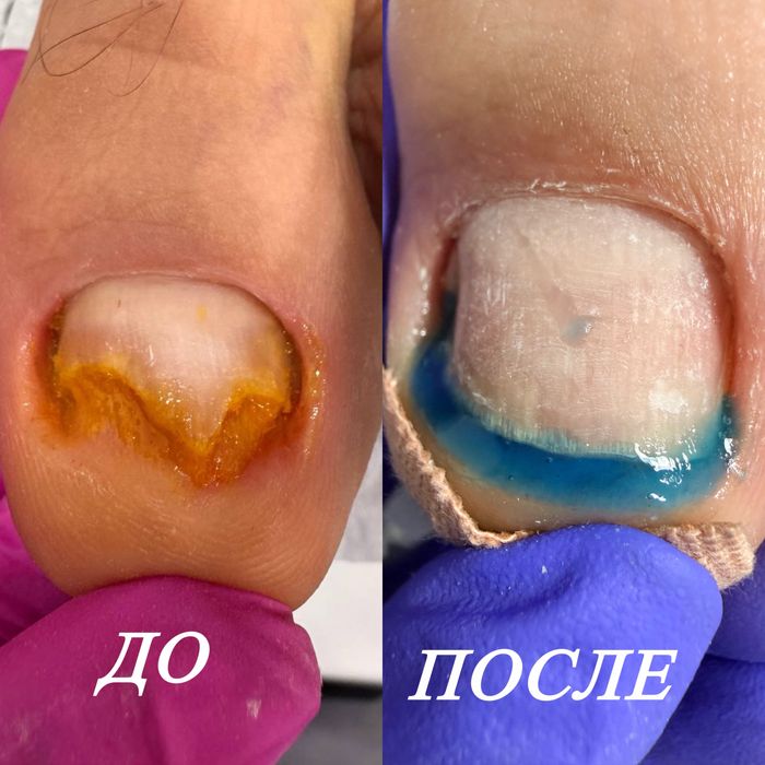 Этга усган тирноклар