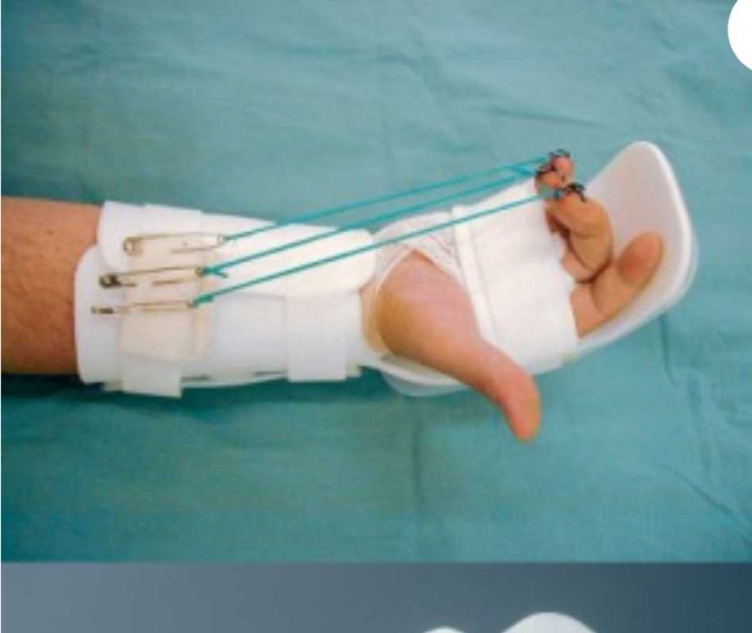 Ортез динамический для кисти руки Ortex