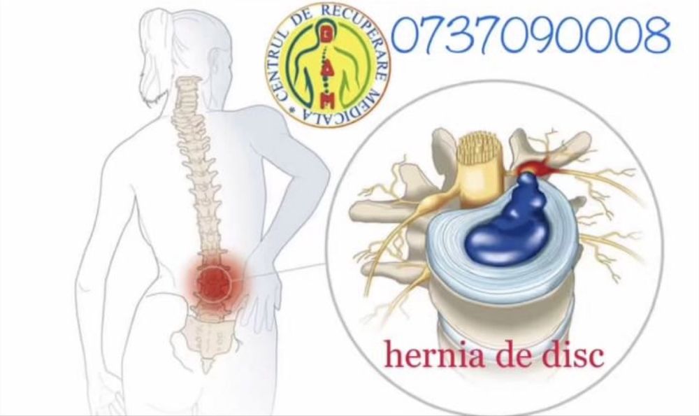 Recuperare medicală cu peste 20 de ani de experiență