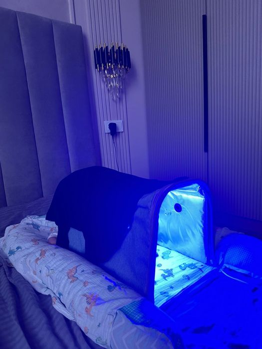 Аренда лампы от желтушки