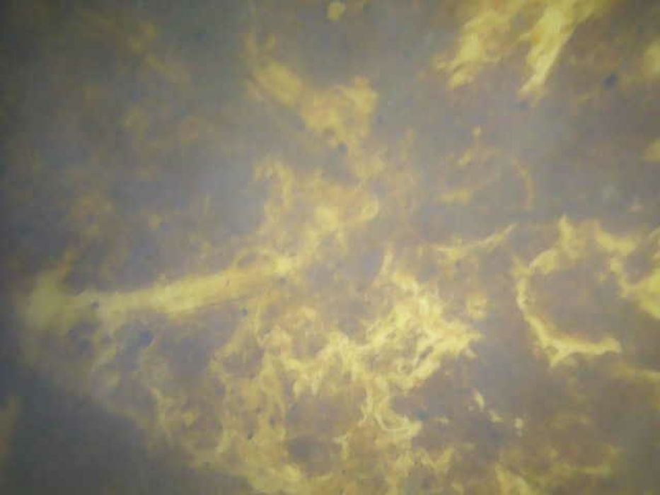 Эндоскоп, фото-видео, қызметі