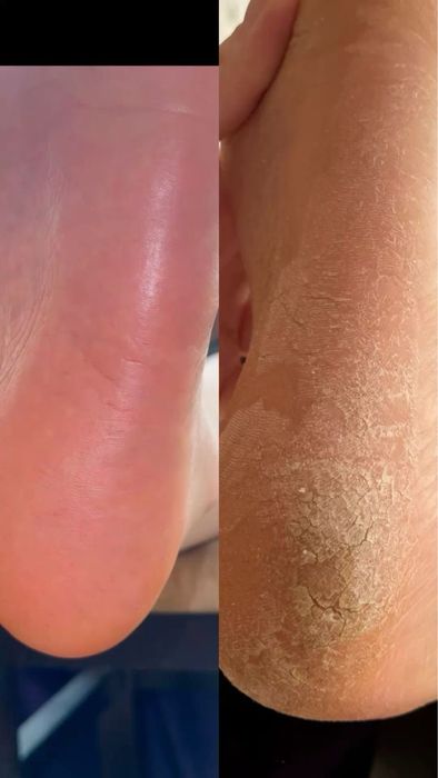 Маникюр / педикюр