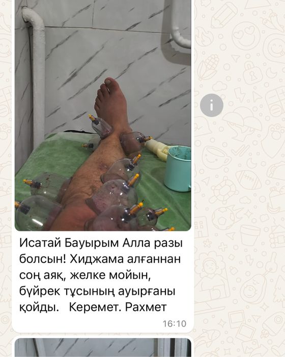 Хиджама и шертпе на выезд в городе Алматы