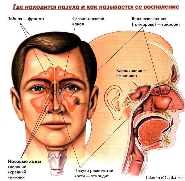 Гайморит/синусит емдеу