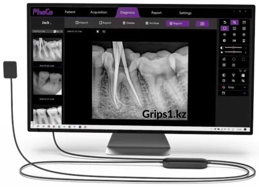 Визиограф PhoCo Mini - сенсор с AI модулем. Радиовизиограф