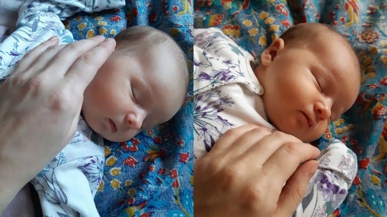 Fotolampa. Fototerapiya. Chaqaloqlarda sariqlik. 100 ming som