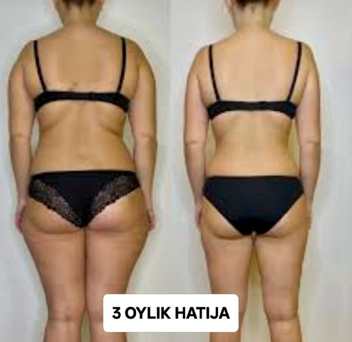 Оземпик, Монархии! Похудения с помощью инъекций. Результат вас удивить