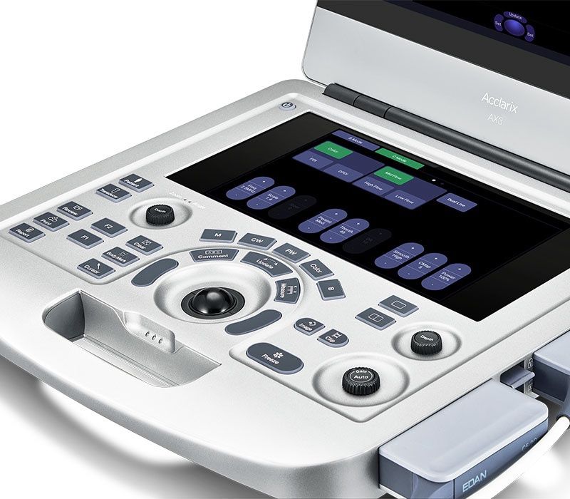 УЗИ / Uzi / в РАССРОЧКУ портативный от ведущих брендов мира «EDAN»