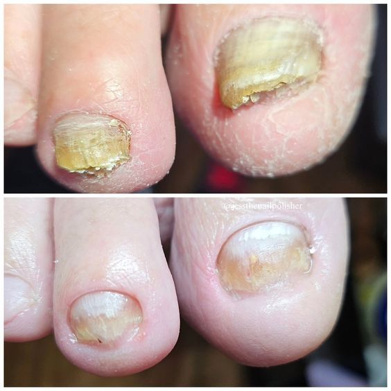 Подолог на выезд