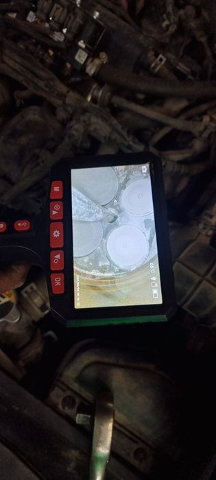 Услуги эндаскоп на выезд