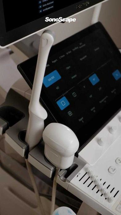 УЗИ аппарат Chison Xbit 80 экспертного класса