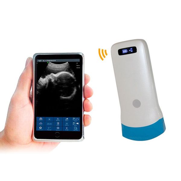 Портативный УЗИ апарат