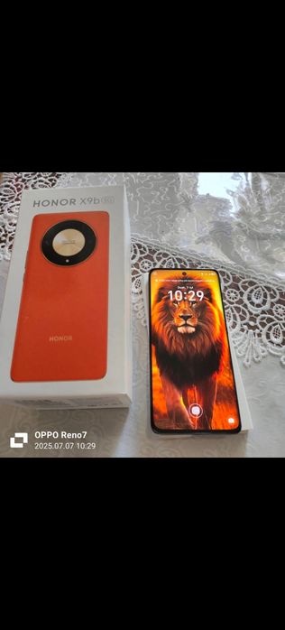 HONOR X9B sotiladi