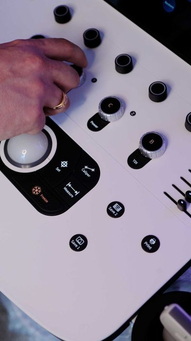 Danus 20 УЗИ-аппарат высокого класса