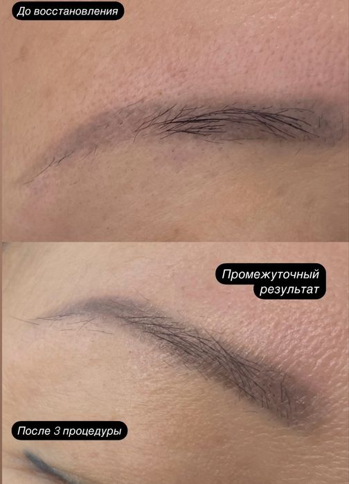 Сыворотка для роста бровей