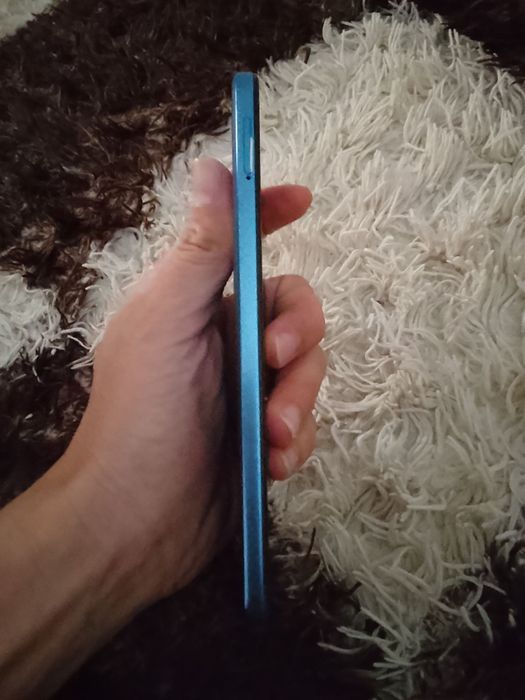 Redmi not 11 holati ideal