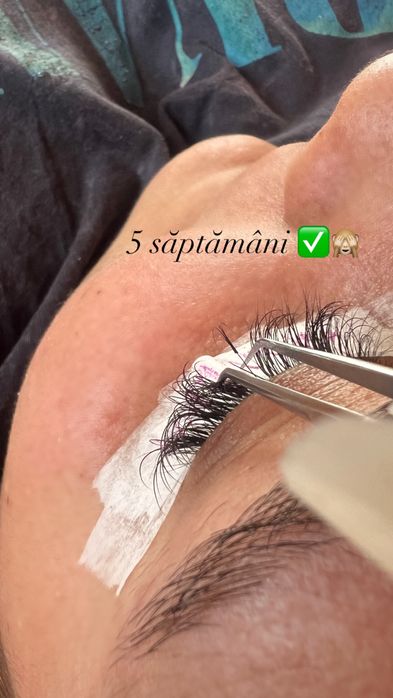 Aplic extensii de gene