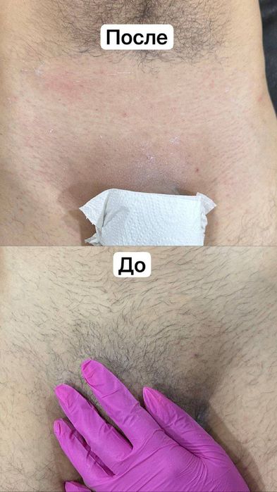 Депиляция эпиляция мужчины и женщины доп услуги есть