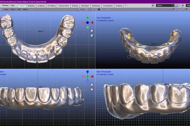 Sum3D под ключ для CAD/CAM лаборатории