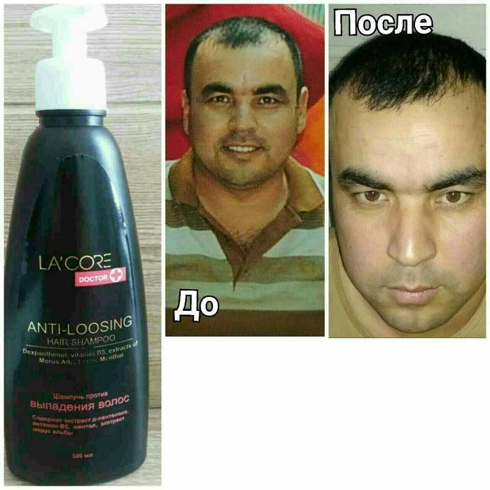 Soch ostiruvchi Shanpoon