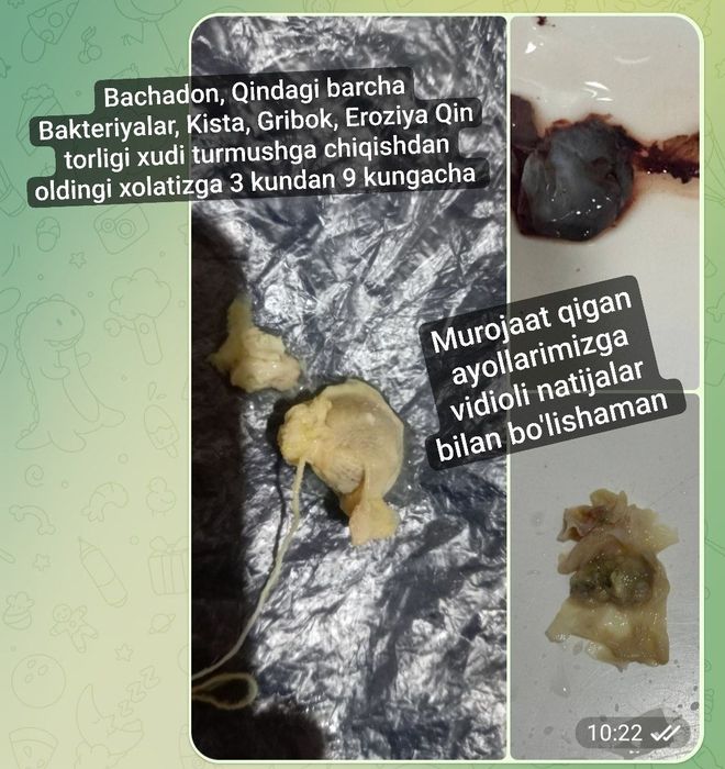 Women's Secret tamponi endi sotuvda