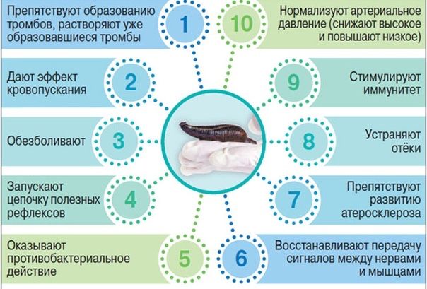 Личение пиявками, сулікпен емдеу