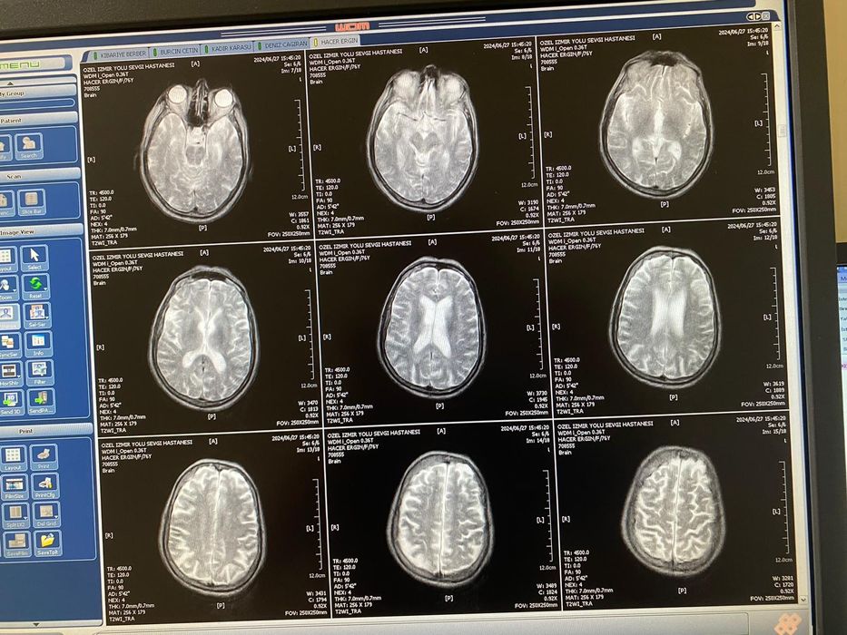 Wandong Open MRI 0.36Tesla (МРТ 0.36T) 2008 Год