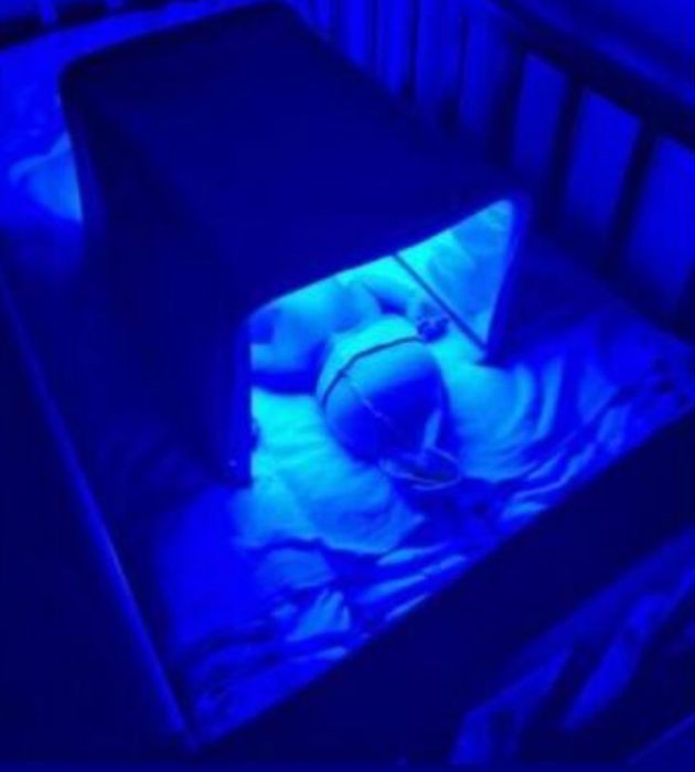 Лампа от желтушка