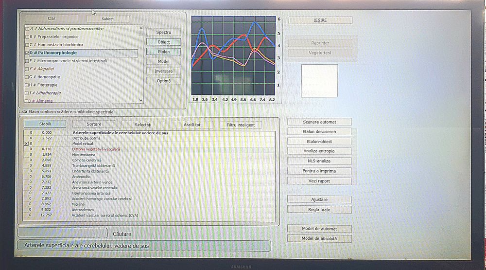 Biorezonanță - scanare și terapie
