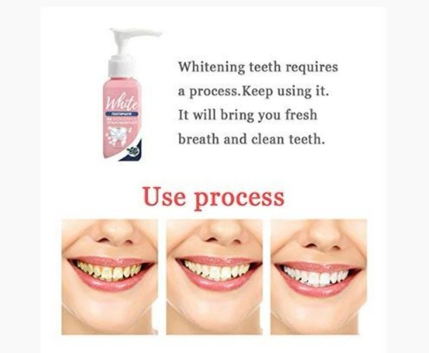 Избелваща паста за зъби